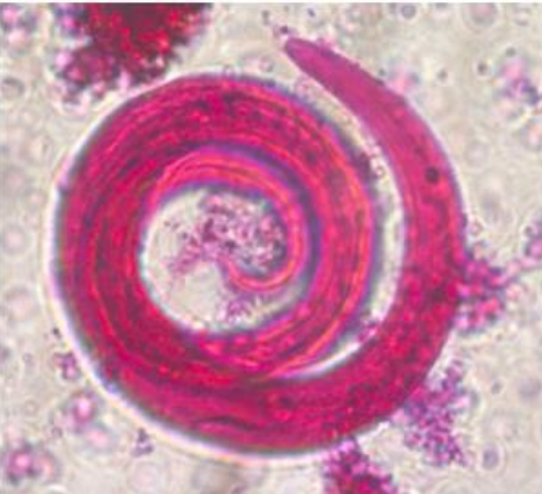 <ul><li><p>Localización: parénquima pulmonar </p></li><li><p>Huésped intermediario: caracol </p></li><li><p>Huésped final : ovino y caprino</p></li><li><p>Ciclo indirecto</p></li><li><p>Extremo posterior en forma de espiral</p></li><li><p>H: repliegue cuticular en su borde posterior.</p></li><li><p>M: bursa copulatriz, espículas en puntas afiladas.</p></li></ul>