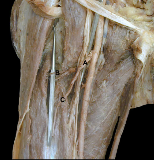 <p>A</p>