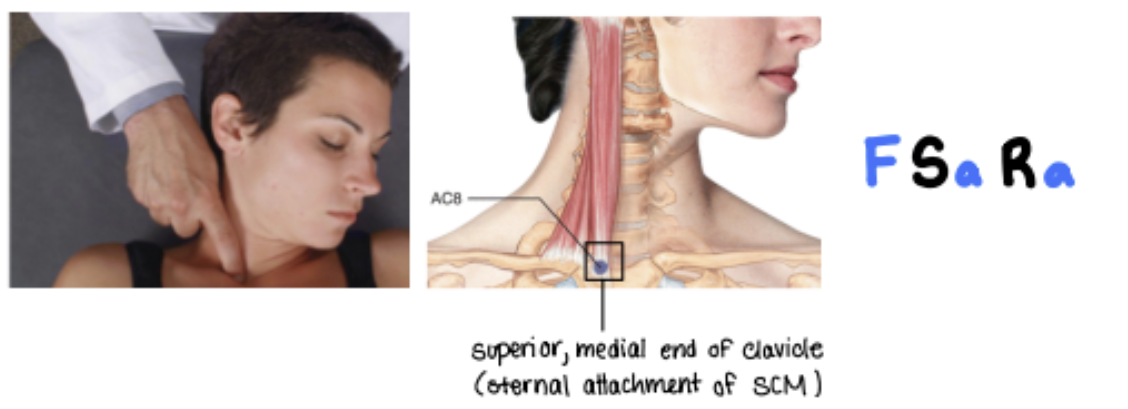 <p>It is Medial compared to AC7.  Find it on top of manubrium and right before it meets with clavicle.</p><p>F SARA</p>