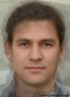 <p>Identify this Phenotype</p>
