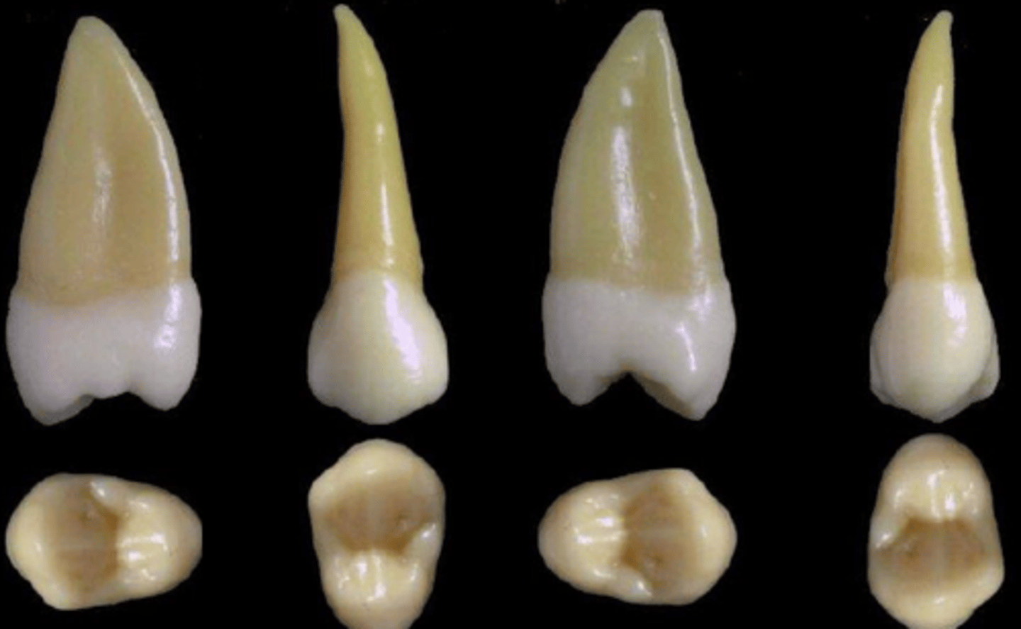 <p>what tooth is this &amp; why?</p>