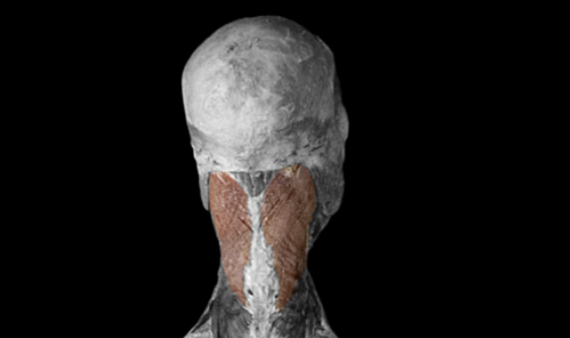 <p>What muscle is this?</p>