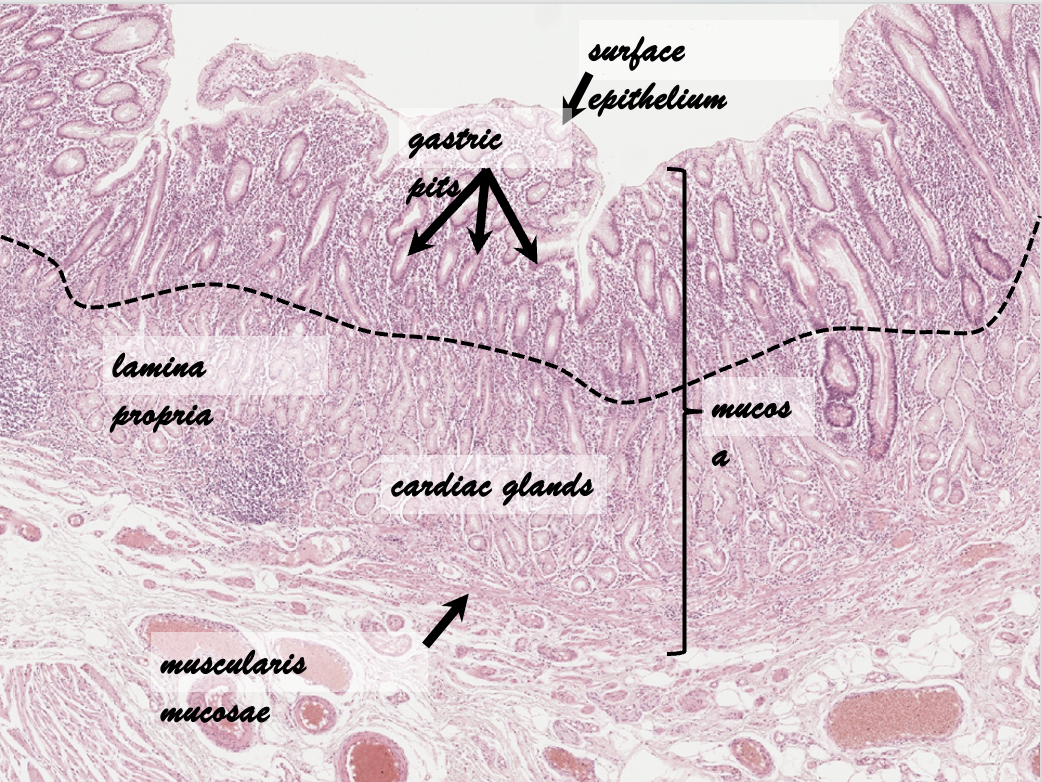 <ul><li><p>Distribution</p><ul><li><p>Narrow ring</p><ul><li><p>Around the esophageal orifice</p></li></ul></li></ul></li><li><p>Function</p><ul><li><p>Production of mucus</p></li><li><p>Protection against acid reflux</p></li></ul></li><li><p>Structure</p><ul><li><p>Branched tubular glands</p></li><li><p>Mucous glands</p></li><li><p>Basal nucleus</p></li><li><p>Mucinogen granules</p></li><li><p>No parietal/chief cells</p></li></ul></li></ul>