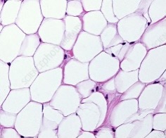 <p>-made up of <strong>adipocytes </strong></p><p><strong>large, pale open cells</strong></p><p><strong>-functions →energy storage</strong> & <strong>physical protection</strong></p>