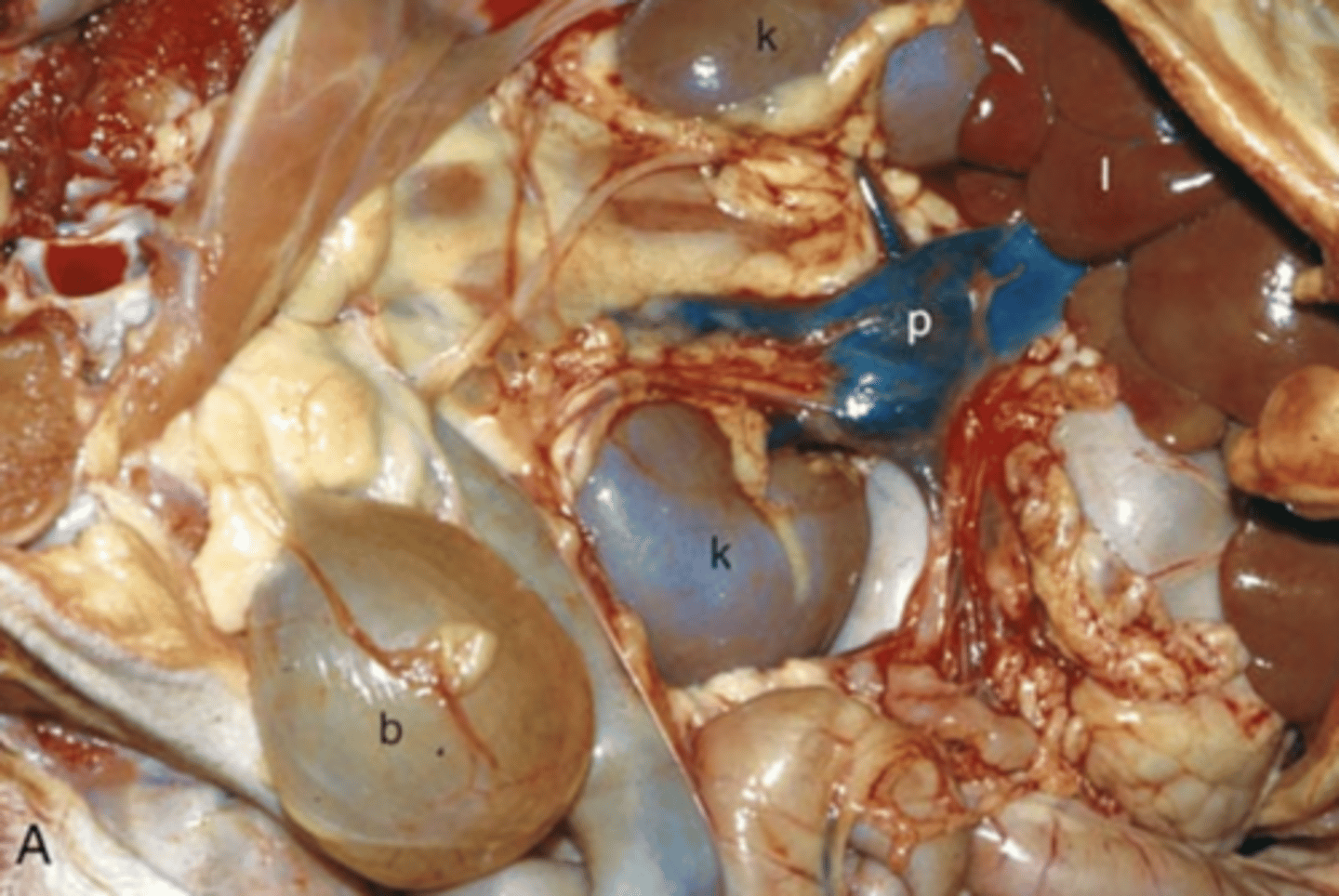 <p>What type of cellular adaptation has the liver undergone in this photo and how do you know?</p>