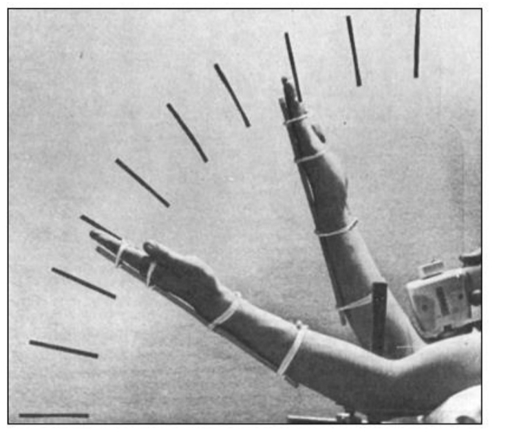 <ul><li><p>E.g., vibration of the biceps (arm perceived as being extended more than it actually is</p></li><li><p>When you&nbsp;<strong>vibrate the tendon of the biceps muscle</strong>, you stimulate the&nbsp;<strong>muscle spindles</strong>&nbsp;unnaturally.</p></li><li><p>This&nbsp;<strong>mimics the signal</strong>&nbsp;the brain would normally get if the muscle were&nbsp;<strong>being stretched</strong>&nbsp;(i.e., the arm is&nbsp;<strong>extending</strong>).</p></li><li><p>But in reality, the arm isn’t moving — the&nbsp;<strong>illusion</strong>&nbsp;is that the arm is&nbsp;<strong>extending or moving away from the body</strong>, even though it’s still.</p></li><li><p>The brain interprets the artificial spindle activation as&nbsp;<strong>real muscle lengthening</strong>, causing a&nbsp;<strong>false sense of movement</strong>.</p></li></ul><p></p>