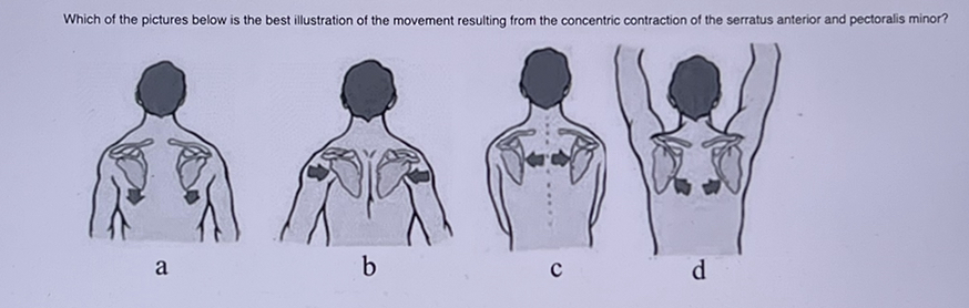 Which of the pictures below is the best illustration of th emovement resulting from the concentric contraction anterior and pectoralis minor? 
