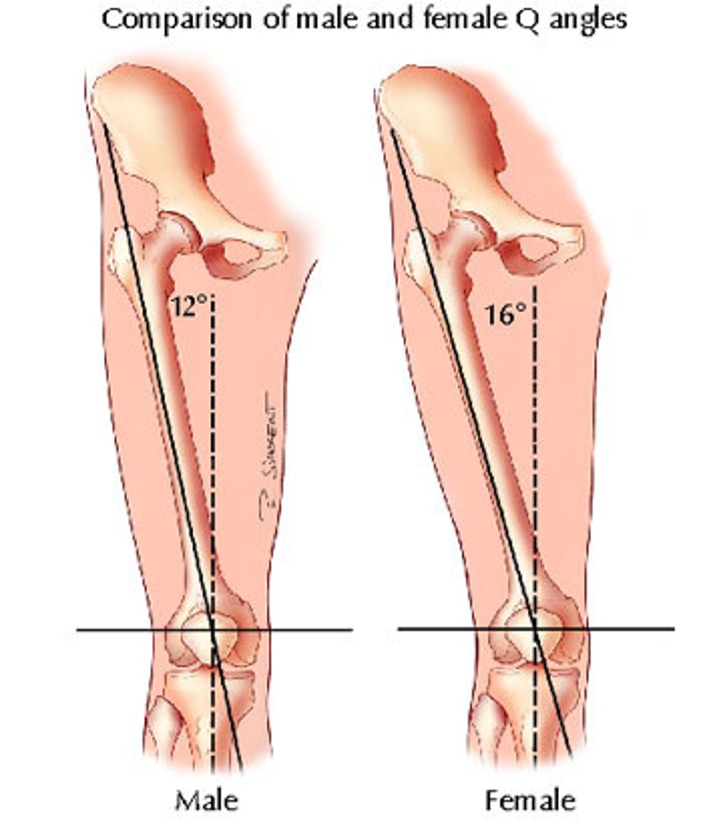 <p>lateral</p><p>RF = excessive Q angle</p>
