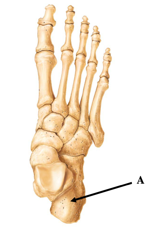 <p>Arrow A is pointing to ____.</p><p></p><p>A. metacarpal</p><p>B. metatarsal</p><p>C. talus</p><p>D. calcaneus</p>