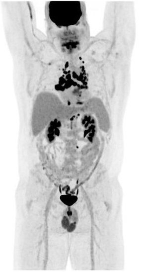 <p><span>Are there other organs in our body that will uptake the tracer F-18 FDG?</span></p>