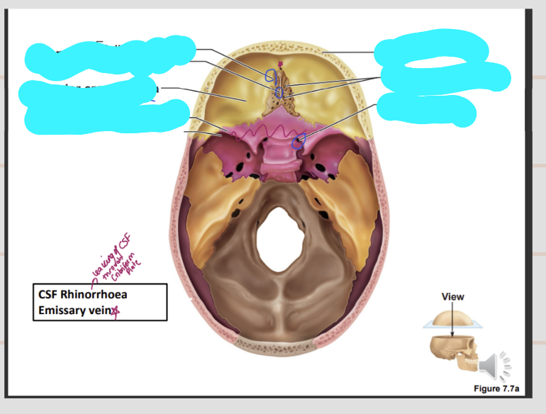 <p>What are the structures found in the anterior cranial fossa </p>