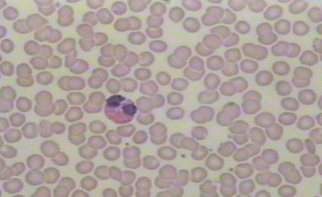 <p>Matrix of this tissue? Plasma</p><p>Function: Transport gases, nutrients and waste</p>