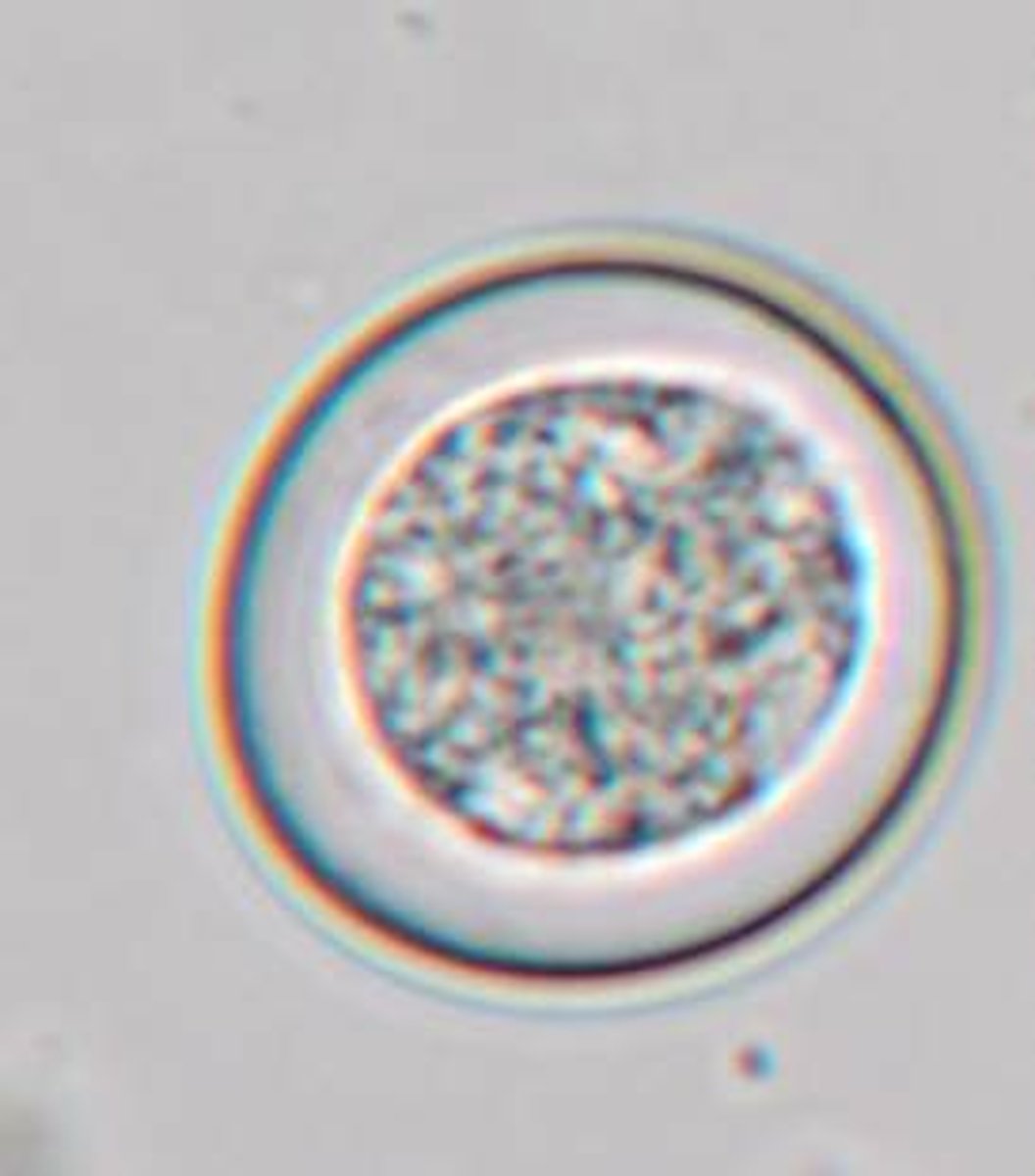 <p>ID the following parasite (puppy)</p><p>~25um</p>
