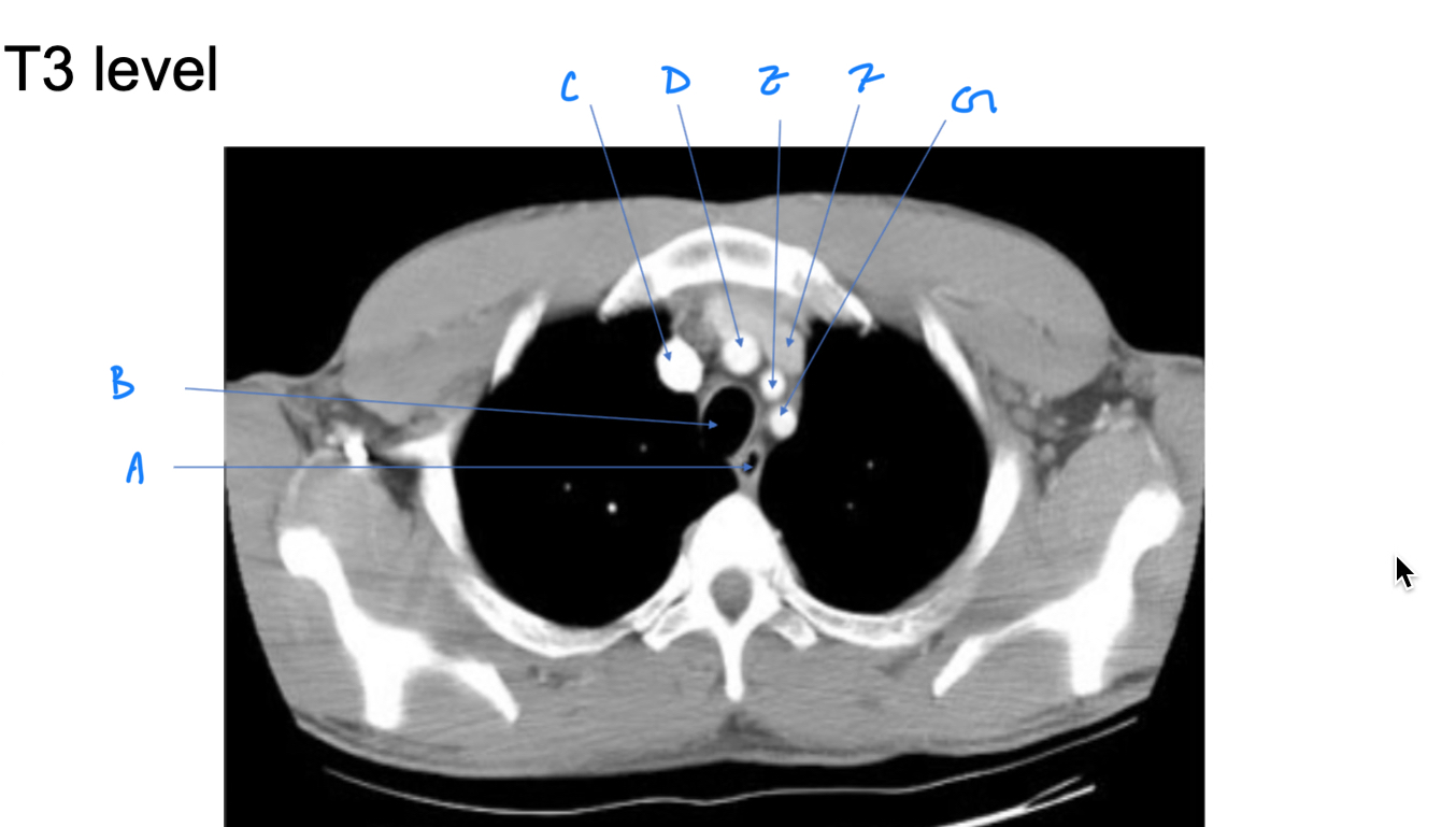 <p>F. Identify</p>