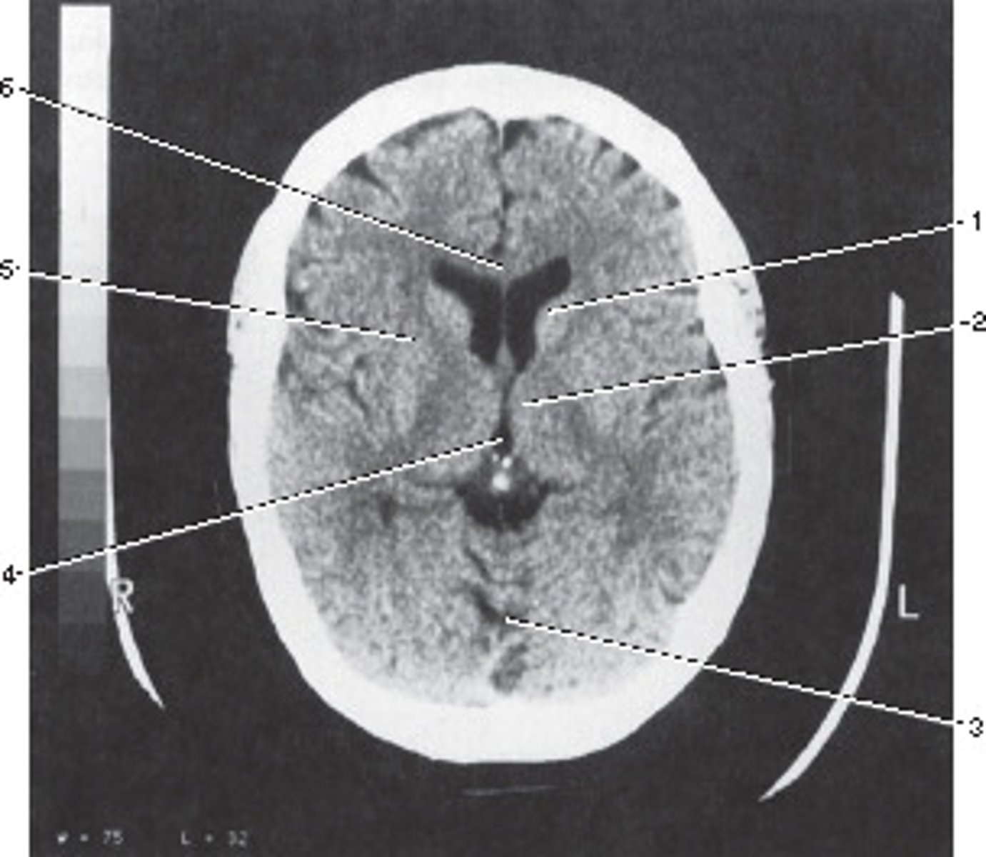 <p>What position should this patient be in for a scan of the brain?</p>