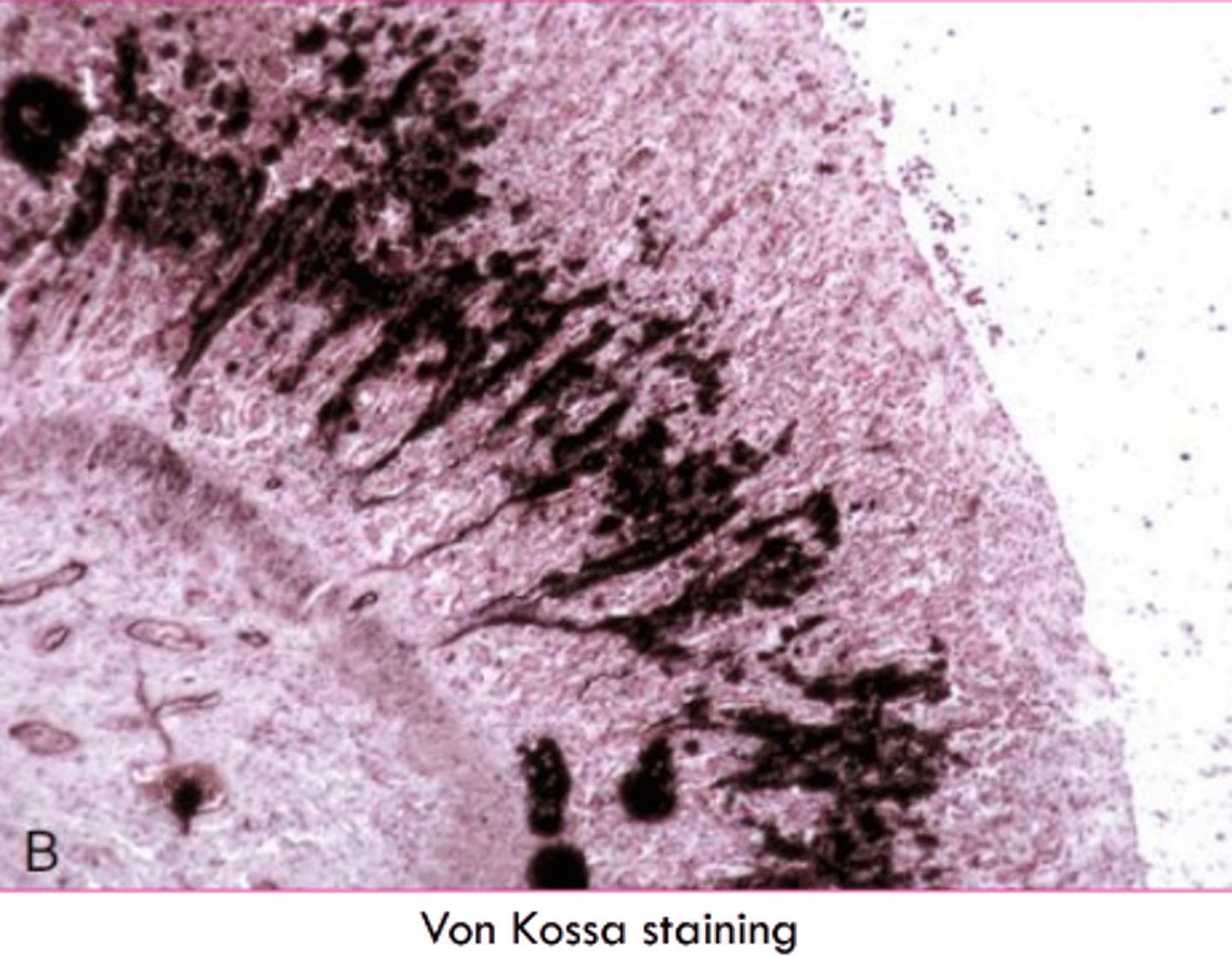 <p>Von Kossa</p><p>silver in stain precipitates with calcium salts and stains black</p>
