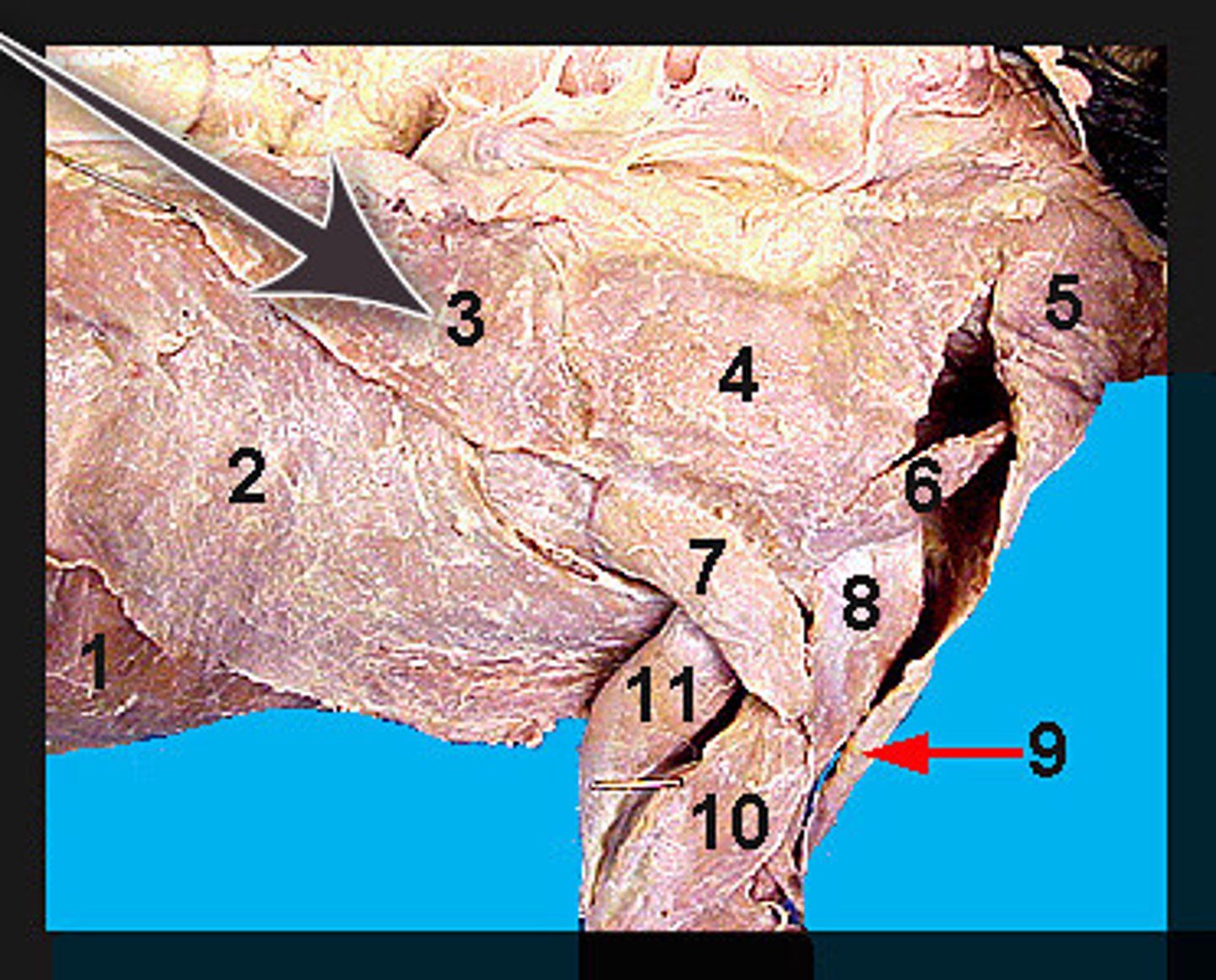 <p>Identify what the brown arrow is pointing to; also labeled number "3"</p>