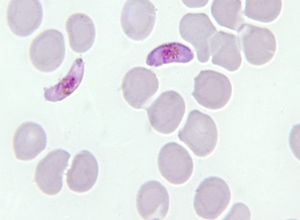 Trophozoite gametocyte Plasmodium falciparum 