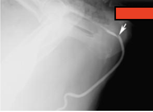 <p>what is the arrow pointing at?</p>