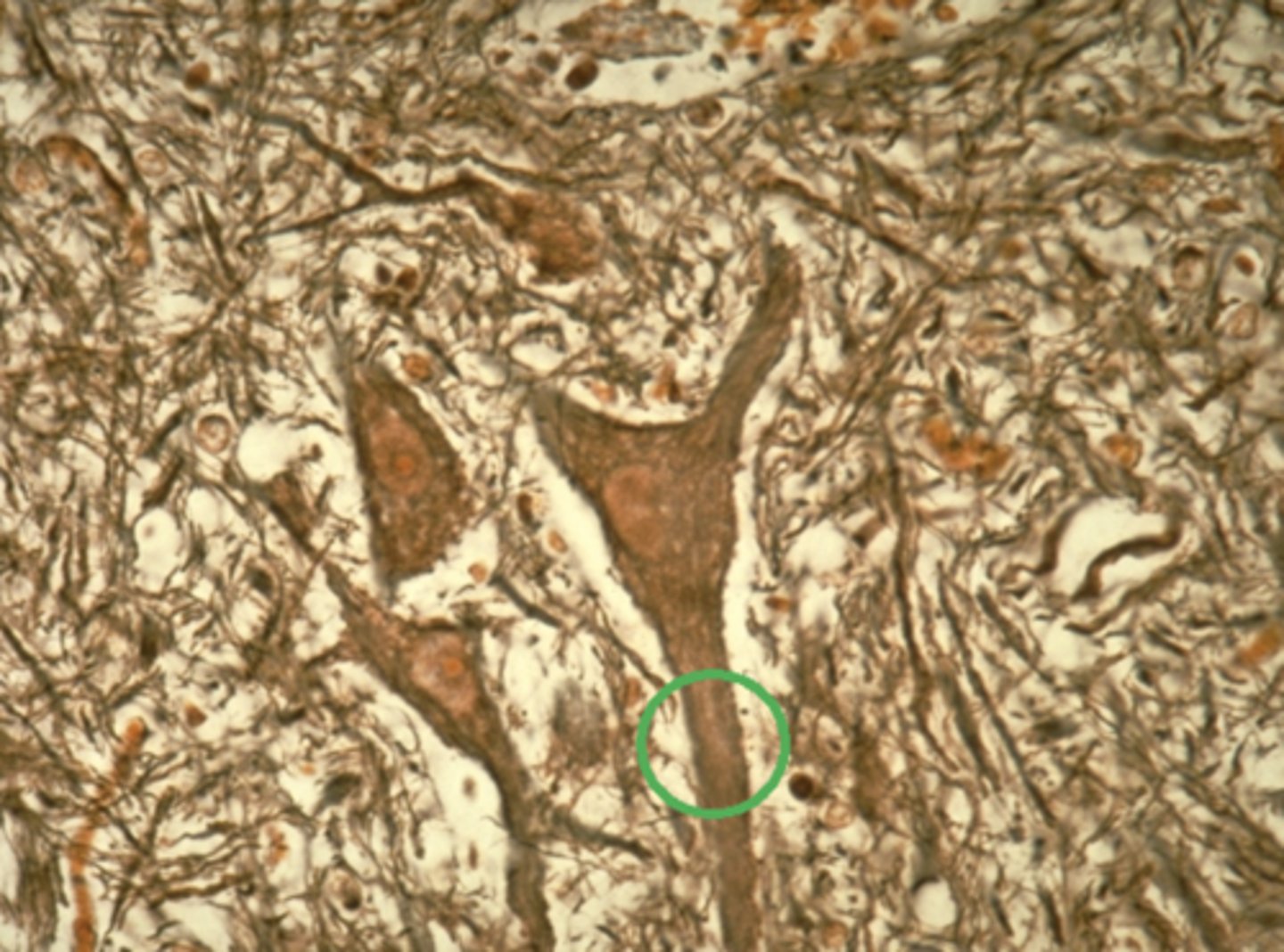 <p>Which feature, circled in green in the previous image, is responsible for transmitting impulses away from the cell body? Nervous tissue</p><p>Cell body</p><p>Dendrite</p><p>Glial cell</p><p>Axon</p>