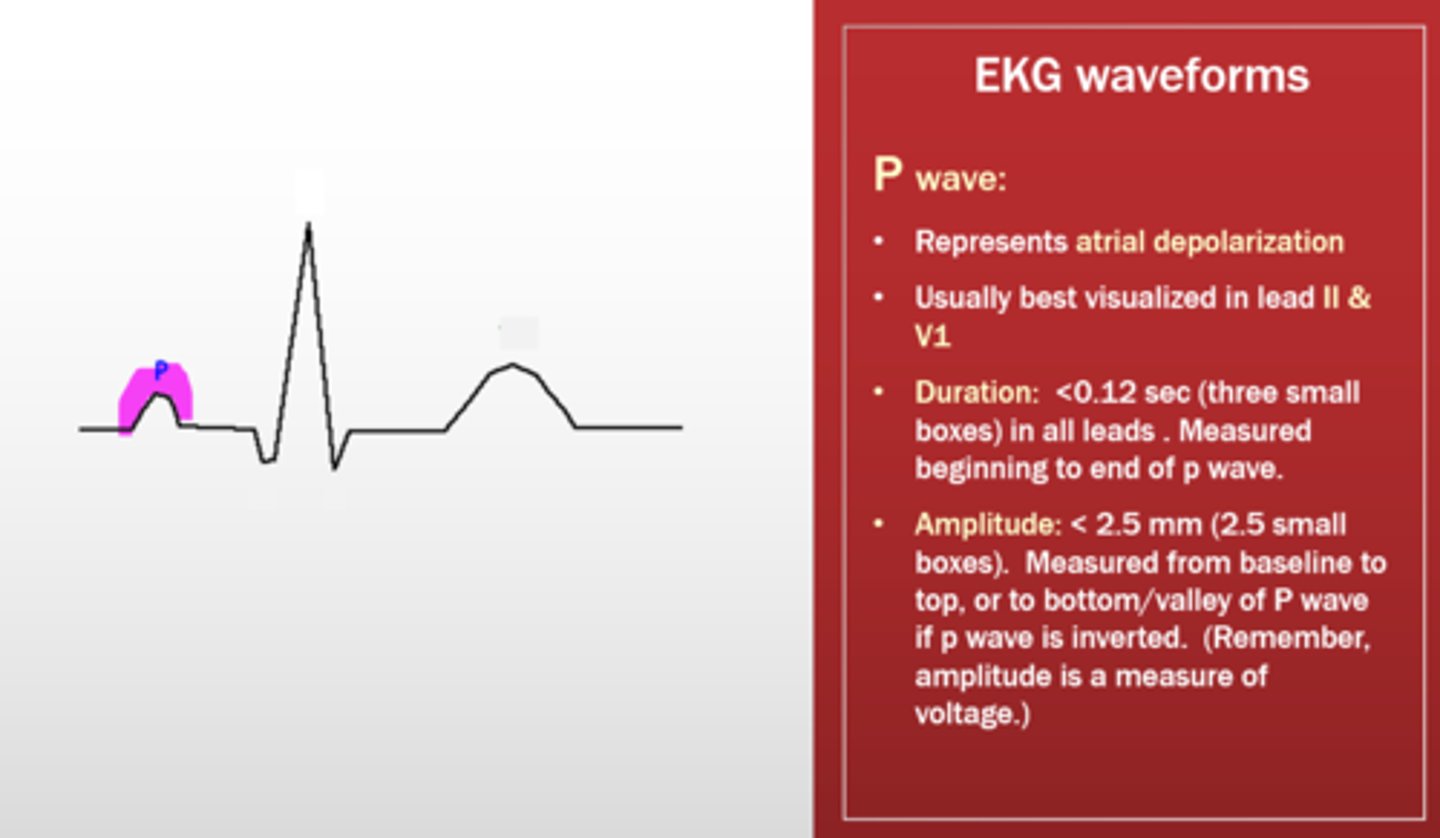 <p>P wave</p>