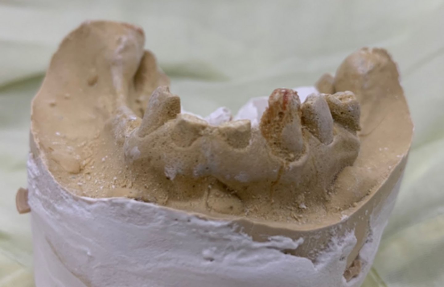 <p>What do you think happen to this cast?</p>