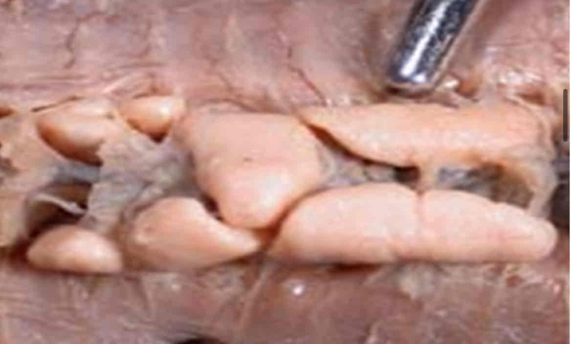 <p>Identify this structure</p>