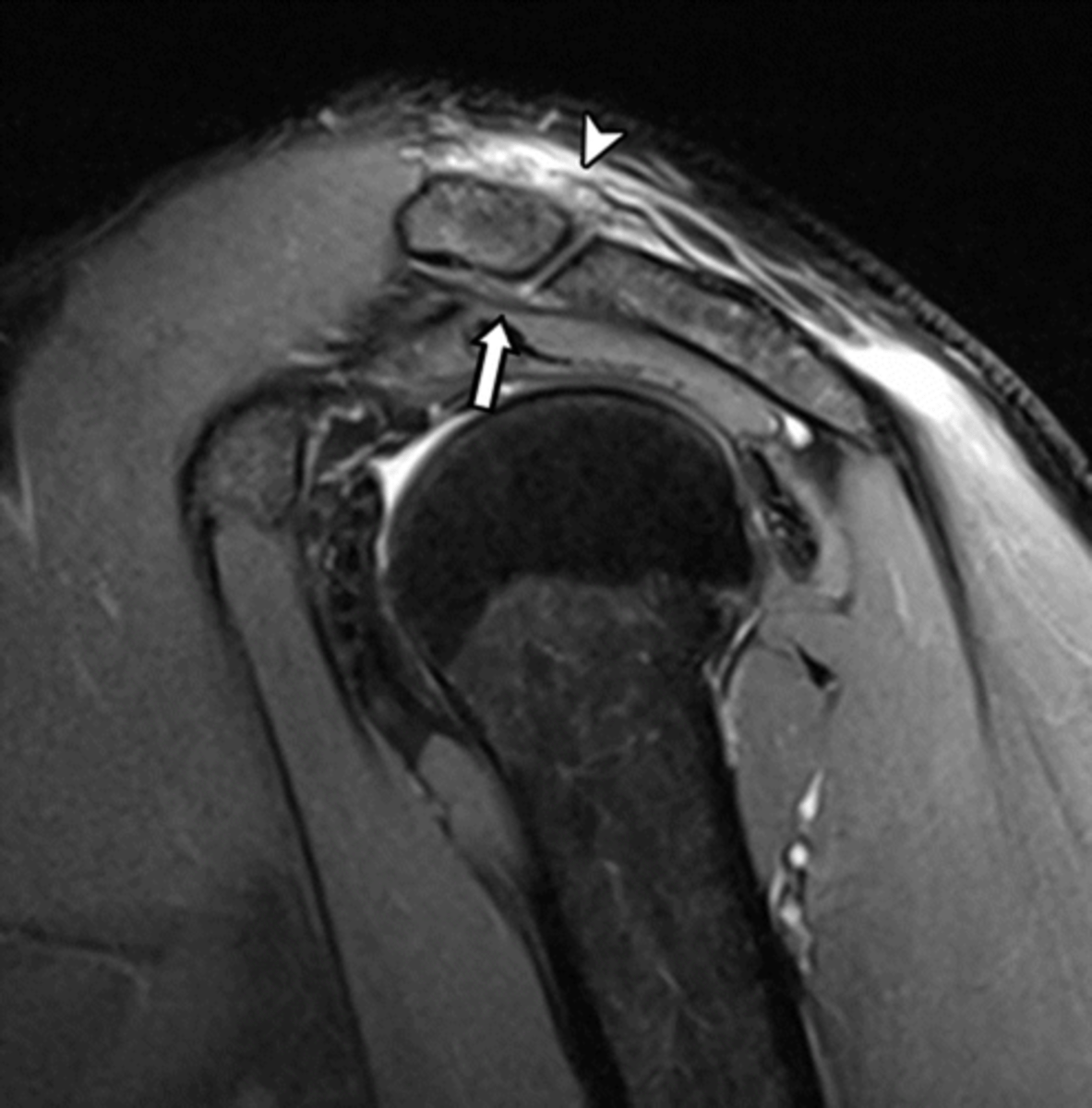 <p>What is this image depicting? How do you know?</p>