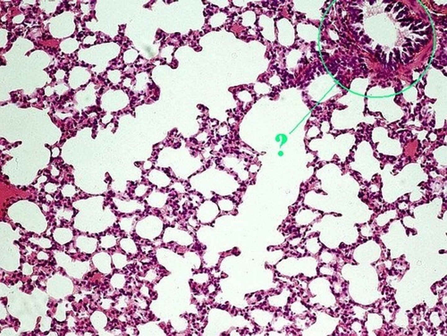 <p>Identify the indicated structure.</p>