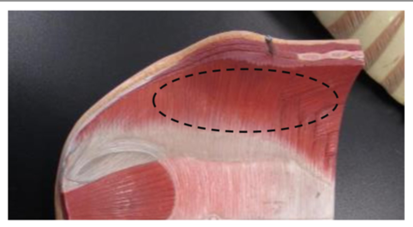 <p>deep red area?</p>