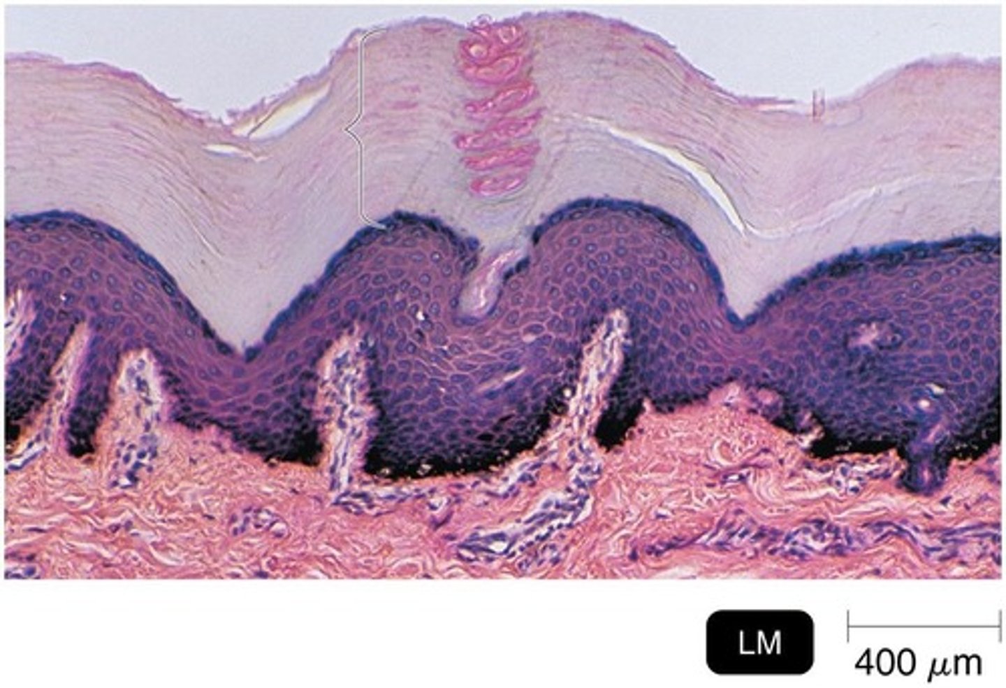 <p>Largest organ of the body; outer most layer composed of dead keratinized cells, high salt concentration, A pH3-5</p>
