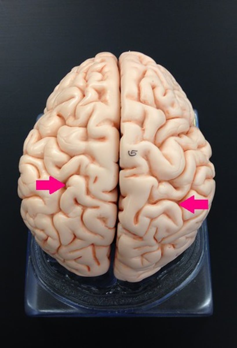 <p>Identify the grooves.</p>