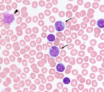 <p>Hint: Look at cells around it</p>