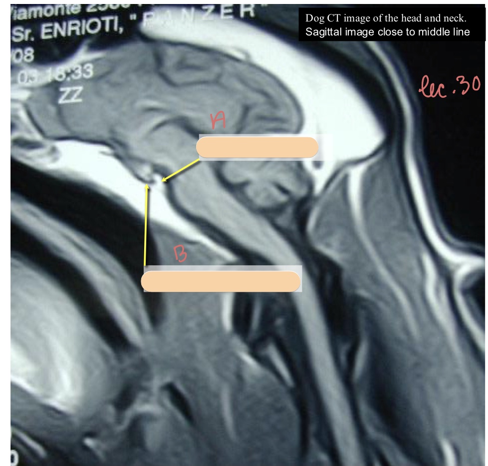 <p>Name the structure(s) indicated by a and b.</p>