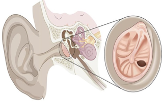 <p>What is the condition or diagnosis called?</p>