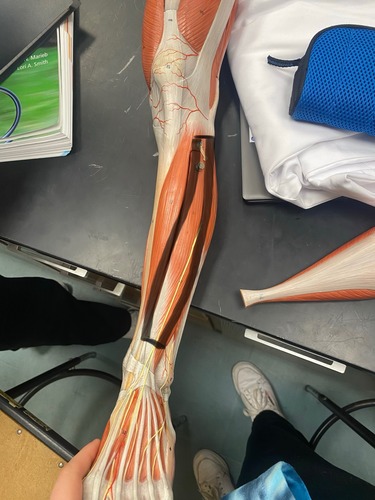 <p>Extends toes 2-5</p>
