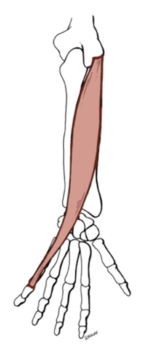 <p>What muscle is this?</p>