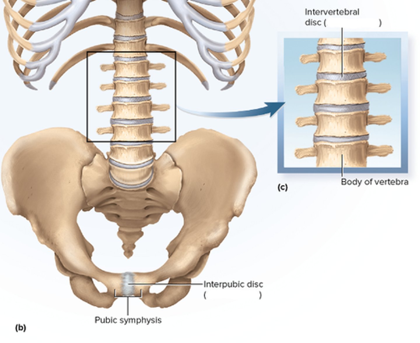 <p>bones joined by fibrocartilage; i.e. pubic symphysis, intervertebral discs</p>