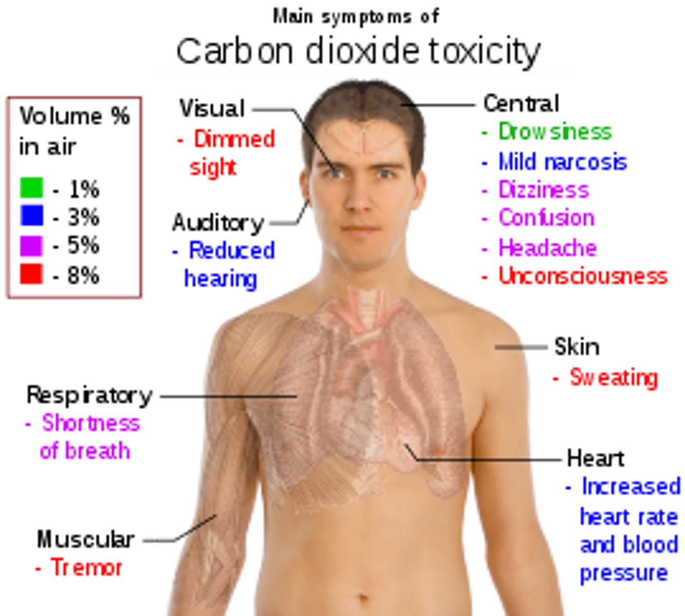 <p>excessive carbon dioxide in the blood</p>