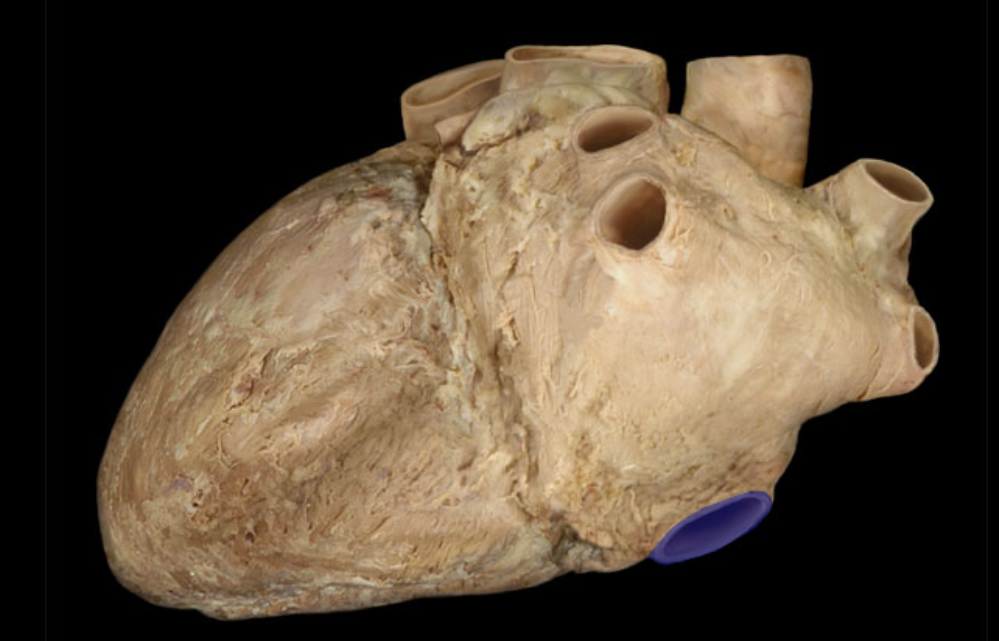 <p>Identify the structure</p>