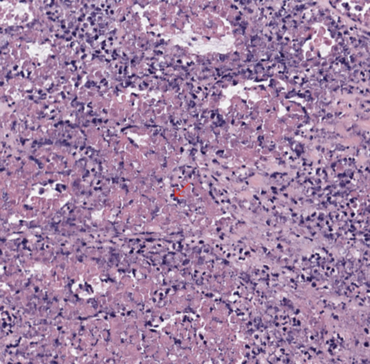 <p>Colon</p>