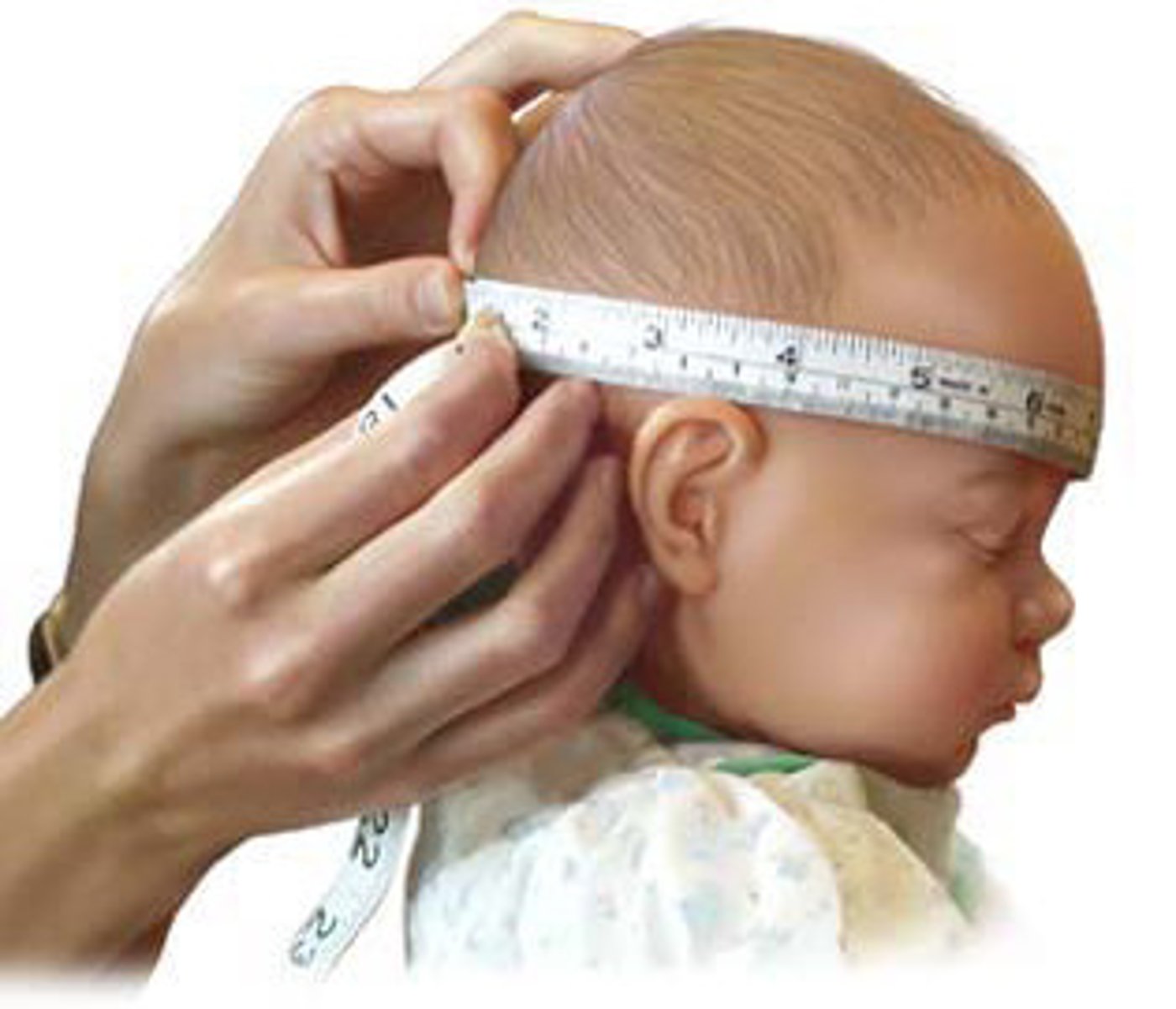 <p>D: Head circumference</p>
