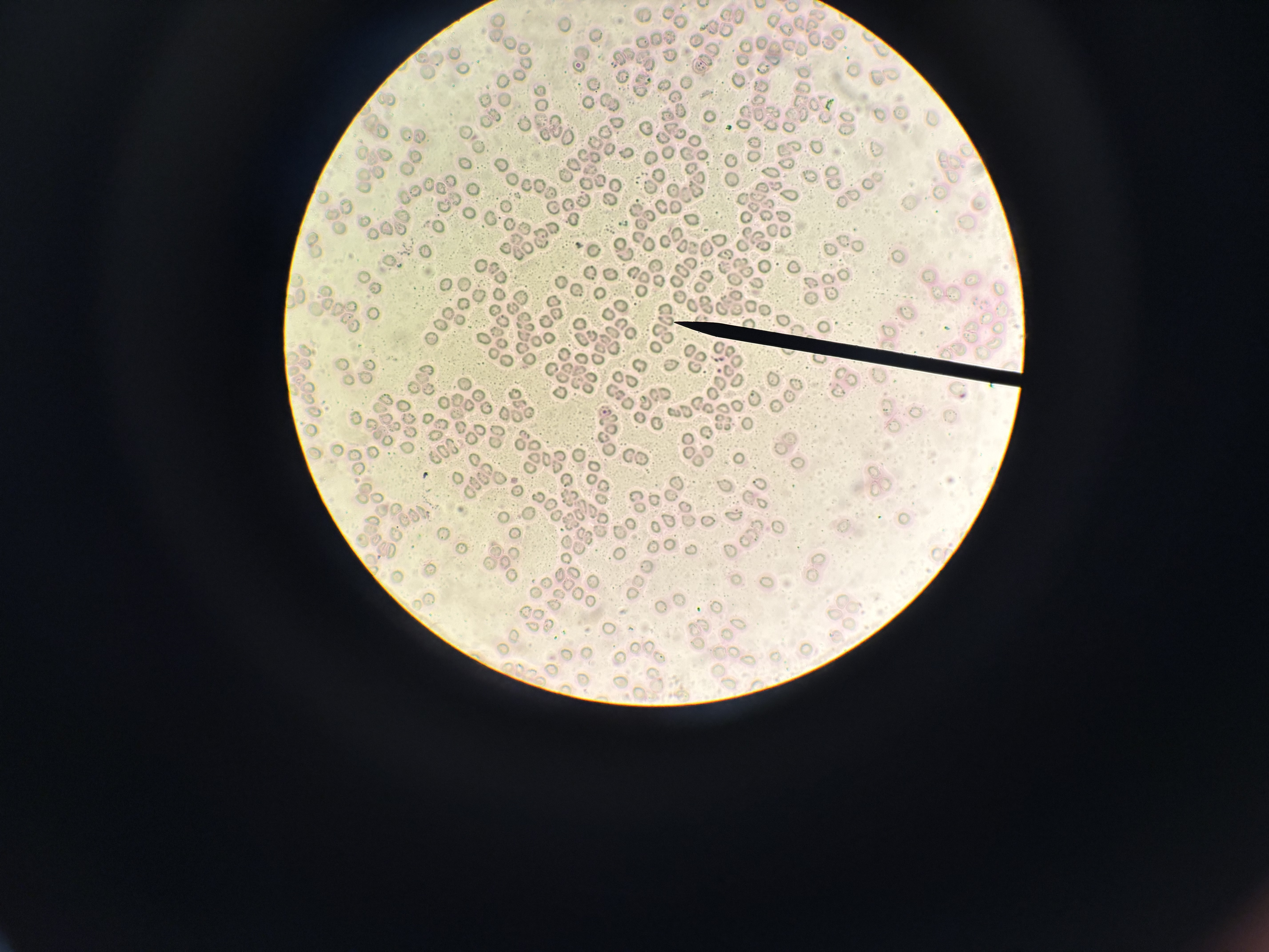 <p>What phylum is this </p>