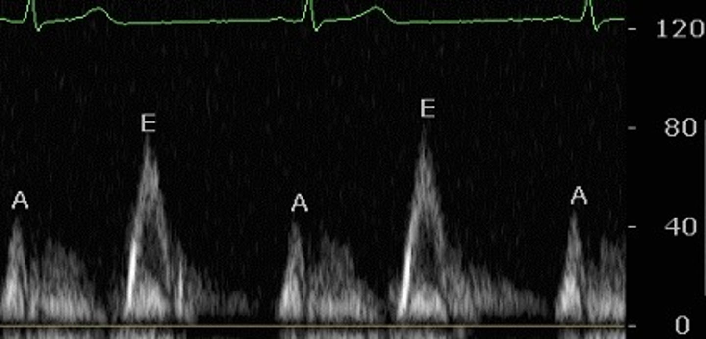 <p>which type of quantitative doppler is this? How can you tell?</p>