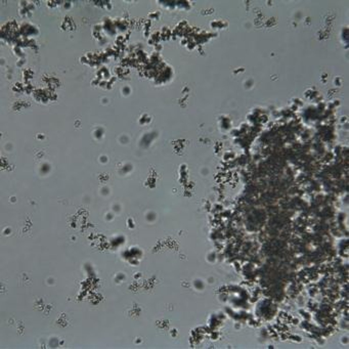 <p>Granulated, multi-lobed nuclei, 12mm diameter, observed under Brightfield at 40x.</p>