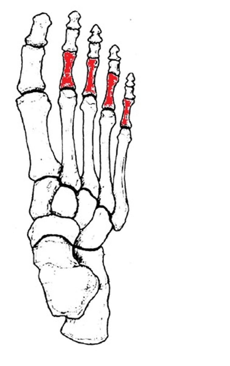 <p>ID bones in red</p>