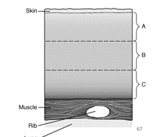 <p>A (anterior)</p><p>B (mid)</p><p>C (posterior)</p>