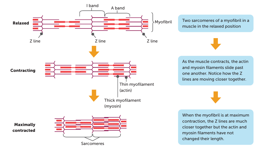 <p><span>. As the thin actin filaments slide inward over the thick myosin filaments toward H zone,&nbsp;Z lines drawn closer together toward the A band (distance between each Z line decreases) and sarcomere shortened</span><span style="color: windowtext">&nbsp;</span></p><p class="Paragraph SCXO2987163 BCX0" style="text-align: left"><span>. Results in a shortening of the muscle fibres and hence a shortening of the whole muscle&nbsp;</span><span style="color: windowtext">&nbsp;</span></p><p class="Paragraph SCXO2987163 BCX0" style="text-align: left"><span>. Myofilaments don't change size (meaning A band stays same length), just overlap more with gaps between filaments shortening (causing the fibril to shorten)&nbsp;</span><span style="color: windowtext">&nbsp;</span></p><p class="Paragraph SCXO2987163 BCX0" style="text-align: left"><span>. I band reduces in length as the thick myosin filaments of each sarcomere draw closer together&nbsp;</span><span style="color: windowtext">&nbsp;</span></p><p class="Paragraph SCXO2987163 BCX0" style="text-align: left"><span>. H zone is reduced in length as the actin filaments are brought closer together (occurs when the myosin heads bind to actin filament/cross bridges of thick filaments connect with actin + pull up and back, moving the actin filament backwards toward the M line, which stays the same size)</span><span style="color: windowtext">&nbsp;</span></p>