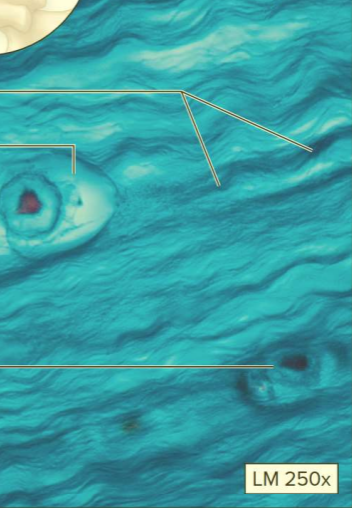 <p>What type of cartilage?</p>