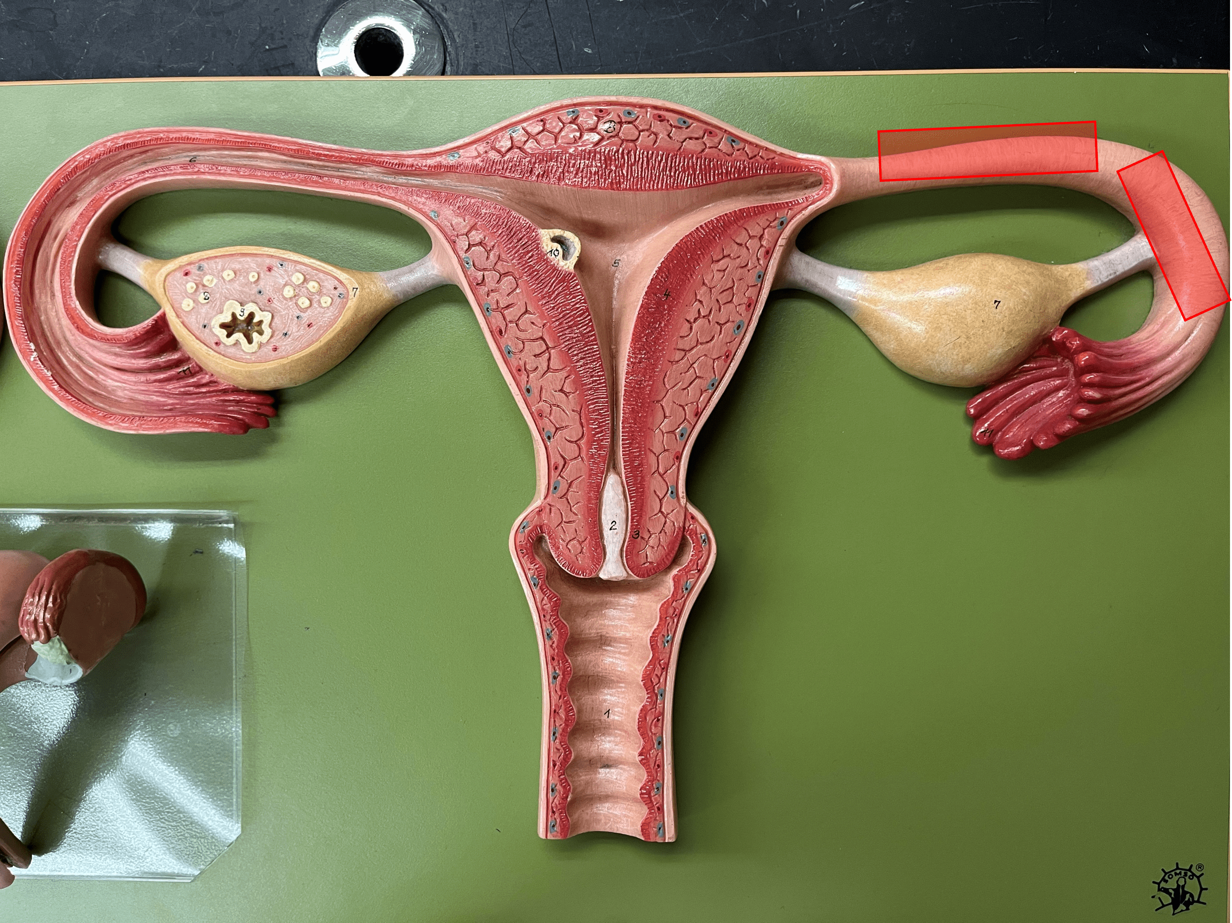 • A region of the uterine tube.

• The main part of the uterine tube.

• The oocyte drifts slowly within it.

• Fertilization normally occurs here.